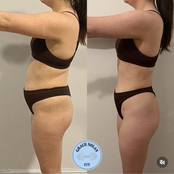 Client transformation